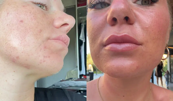 Mein Kinn ist endlich ruhig