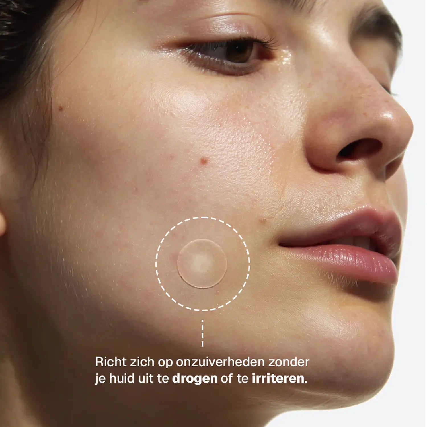 Clear Dots – Pickel-Patches