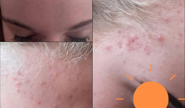 Ihre Haut und Haare wurden ruhiger, und sie selbst auch.