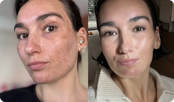 Meine Haut ist ruhiger und ebenmäßiger