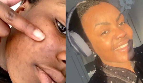 Es fing mit weniger Talg an