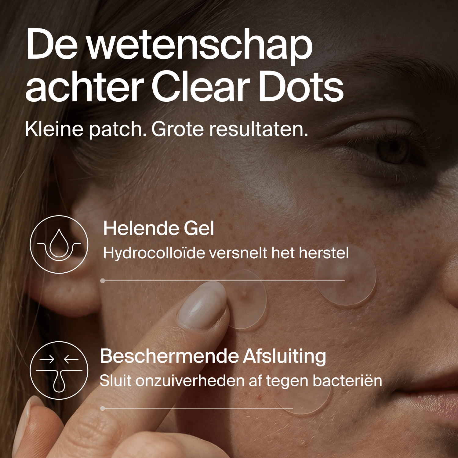 Clear Dots – Akne-Patches