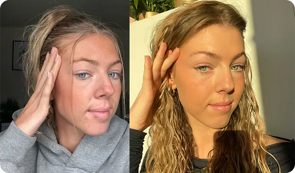 Ich dachte, das gehört zu meiner Haut